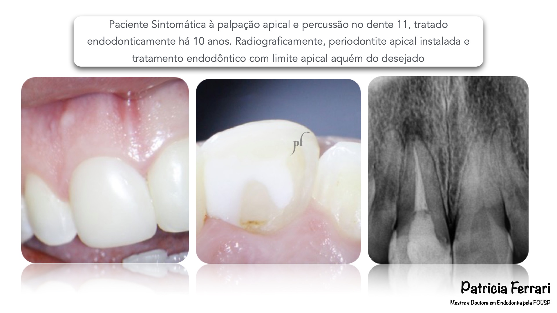 Central Superior Patricia Ferrari Endodontia