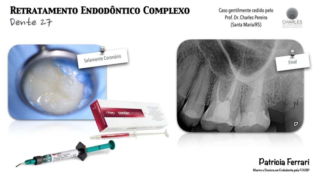 Retratamento Endod Ntico Complexo By Prof Charles Pereira Santa Maria Rs Patricia Ferrari